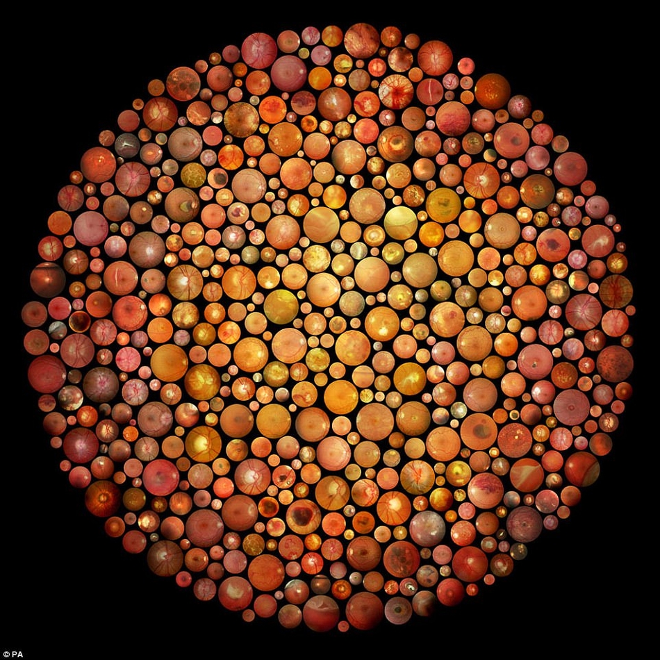 令人叹为观止的科学摄影图片：猪肉绦虫宛如恶魔